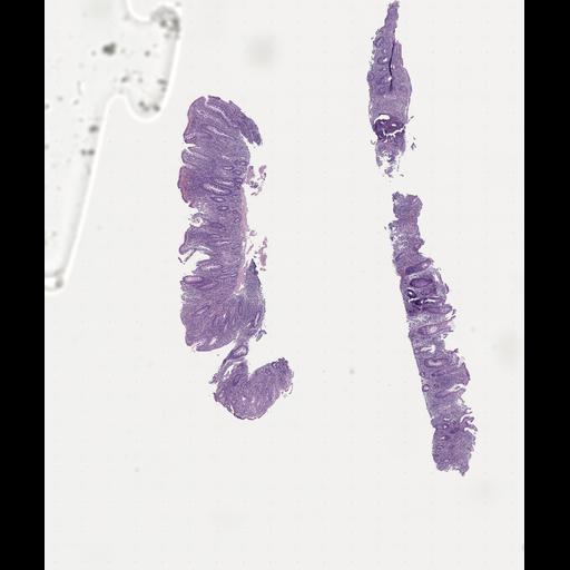  NCBI Organism:Homo sapiens, ; Biological process:;