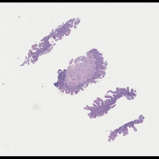  NCBI Organism:Homo sapiens, ; Biological process:;