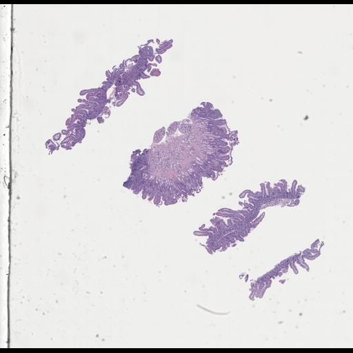  NCBI Organism:Homo sapiens, ; Biological process:;