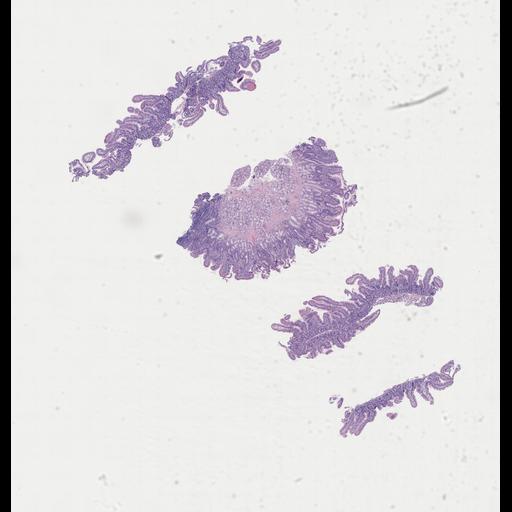  NCBI Organism:Homo sapiens, ; Biological process:;