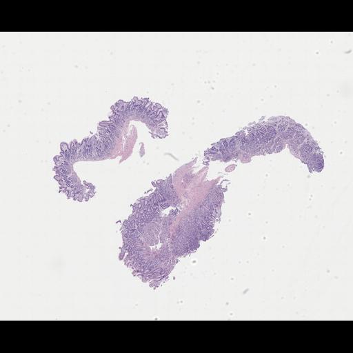  NCBI Organism:Homo sapiens, ; Biological process:;