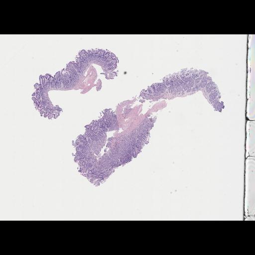  NCBI Organism:Homo sapiens, ; Biological process:;