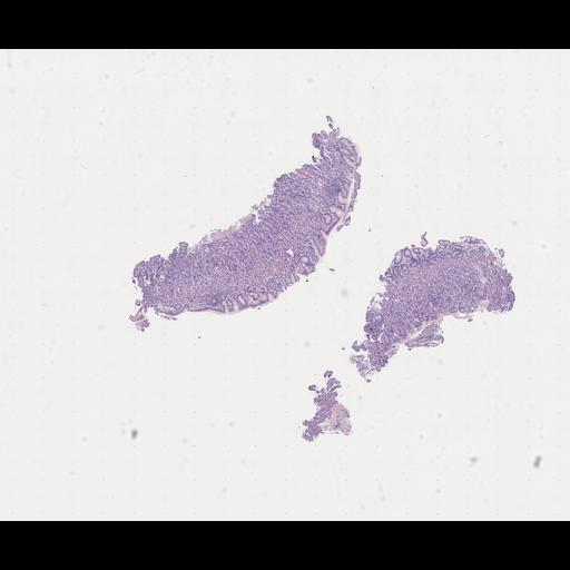  NCBI Organism:Homo sapiens, ; Biological process:;