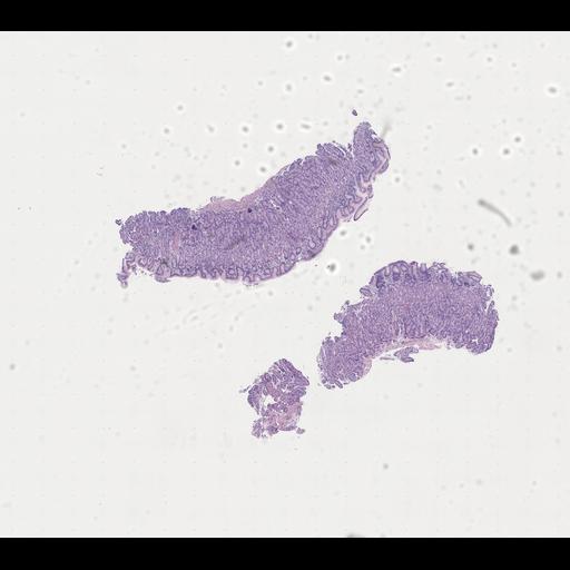  NCBI Organism:Homo sapiens, ; Biological process:;