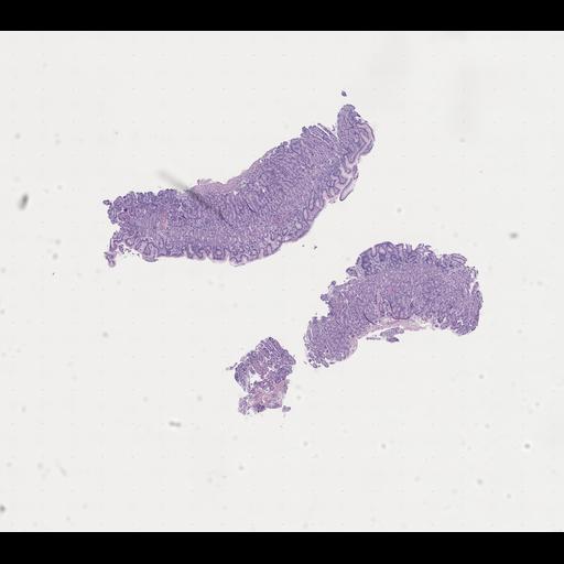  NCBI Organism:Homo sapiens, ; Biological process:;