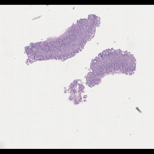  NCBI Organism:Homo sapiens, ; Biological process:;