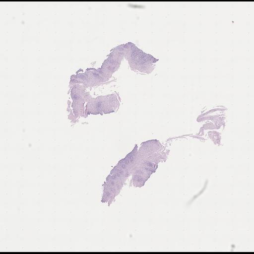  NCBI Organism:Homo sapiens, ; Biological process:;