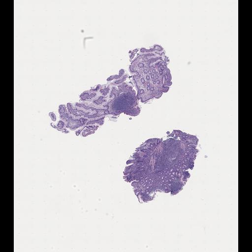  NCBI Organism:Homo sapiens, ; Biological process:;