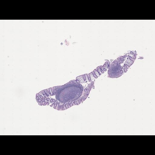  NCBI Organism:Homo sapiens, ; Biological process:;