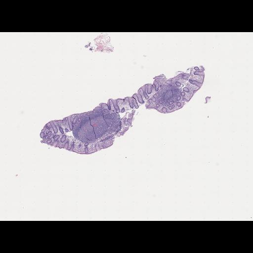  NCBI Organism:Homo sapiens, ; Biological process:;