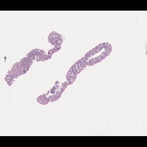  NCBI Organism:Homo sapiens, ; Biological process:;