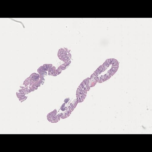  NCBI Organism:Homo sapiens, ; Biological process:;