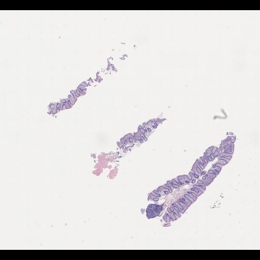  NCBI Organism:Homo sapiens, ; Biological process:;