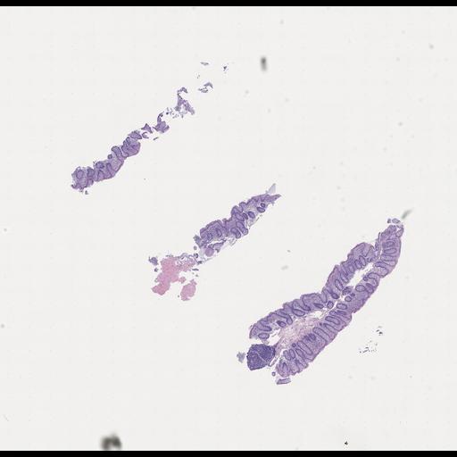  NCBI Organism:Homo sapiens, ; Biological process:;