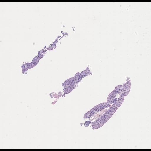  NCBI Organism:Homo sapiens, ; Biological process:;