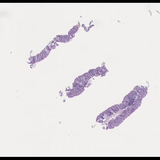  NCBI Organism:Homo sapiens, ; Biological process:;