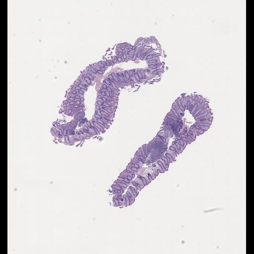  NCBI Organism:Homo sapiens, ; Biological process:;