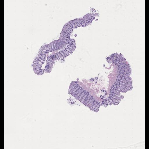  NCBI Organism:Homo sapiens, ; Biological process:;