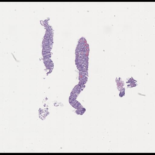  NCBI Organism:Homo sapiens, ; Biological process:;