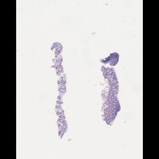  NCBI Organism:Homo sapiens, ; Biological process:;