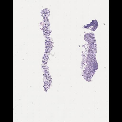  NCBI Organism:Homo sapiens, ; Biological process:;