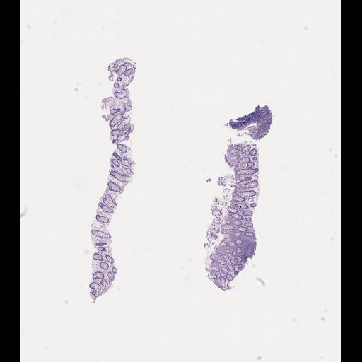  NCBI Organism:Homo sapiens, ; Biological process:;