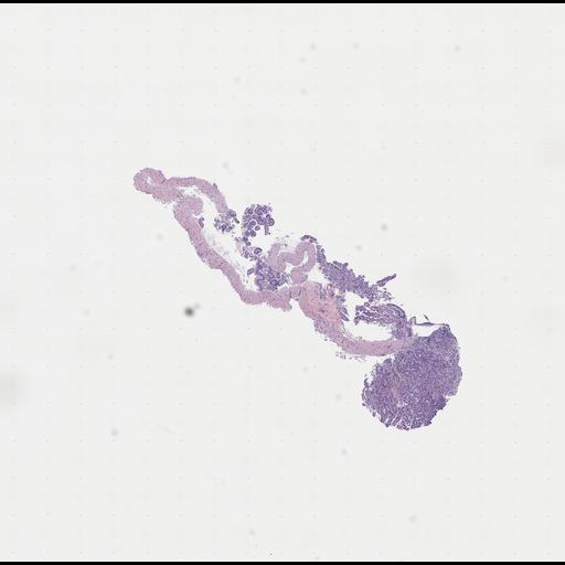  NCBI Organism:Homo sapiens, ; Biological process:;