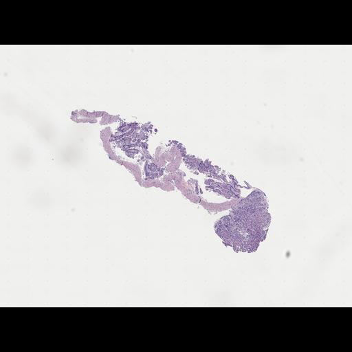  NCBI Organism:Homo sapiens, ; Biological process:;