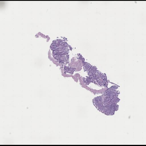  NCBI Organism:Homo sapiens, ; Biological process:;