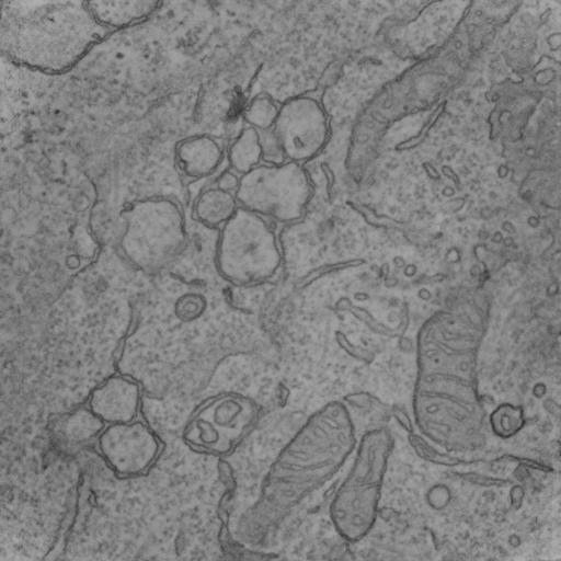  NCBI Organism:Mus musculus, ; Cell Types:; Cell Components:nuclear membrane; Biological process:;