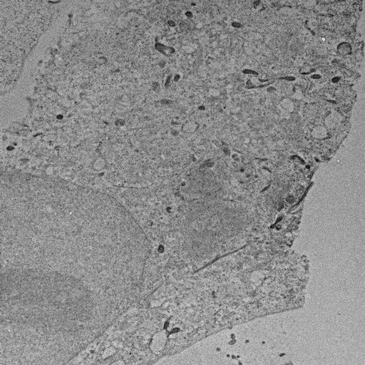  NCBI Organism:, ; Cell Types:; Cell Components:; Biological process:;