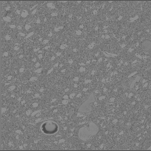  NCBI Organism:Mus musculus, ; Cell Types:; Cell Components:;