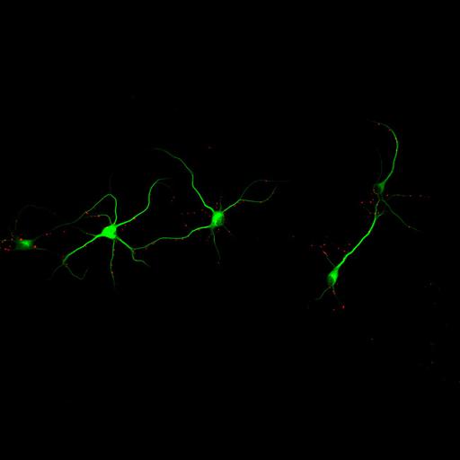  NCBI Organism:Rattus; Cell Types:multipolar neuron Cell Components:cytoskeleton, microtubule cytoskeleton, dendrite, synapse part, synaptic vesicle; Biological process:neuron development, dendrite development, protein localization to synapse, establishment of cell polarity;