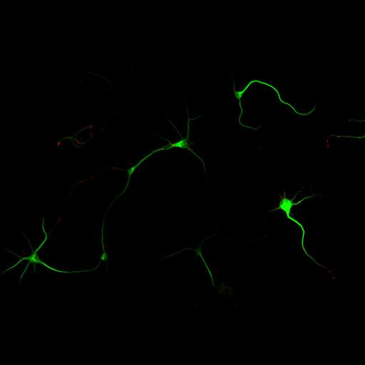  NCBI Organism:Rattus; Cell Types:multipolar neuron Cell Components:cytoskeleton, microtubule cytoskeleton, dendrite, synapse part, synaptic vesicle; Biological process:neuron development, dendrite development, protein localization to synapse, establishment of cell polarity;