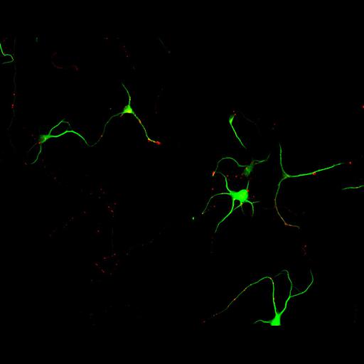  NCBI Organism:Rattus; Cell Types:multipolar neuron Cell Components:cytoskeleton, microtubule cytoskeleton, dendrite, synapse part, synaptic vesicle; Biological process:neuron development, dendrite development, protein localization to synapse, establishment of cell polarity;