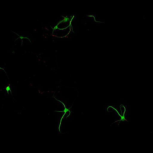  NCBI Organism:Rattus; Cell Types:multipolar neuron Cell Components:cytoskeleton, microtubule cytoskeleton, dendrite, synapse part, synaptic vesicle; Biological process:neuron development, dendrite development, protein localization to synapse, establishment of cell polarity;