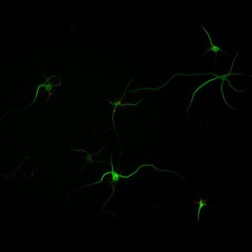  NCBI Organism:Rattus; Cell Types:multipolar neuron Cell Components:cytoskeleton, microtubule cytoskeleton, dendrite, synapse part, synaptic vesicle; Biological process:neuron development, dendrite development, protein localization to synapse, establishment of cell polarity;