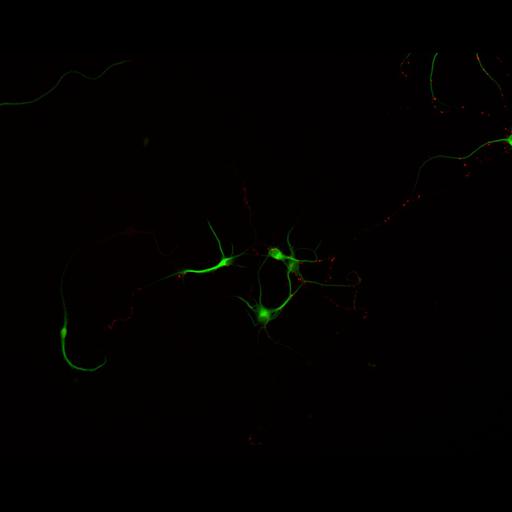  NCBI Organism:Rattus; Cell Types:multipolar neuron Cell Components:cytoskeleton, microtubule cytoskeleton, dendrite, synapse part, synaptic vesicle; Biological process:neuron development, dendrite development, protein localization to synapse, establishment of cell polarity;