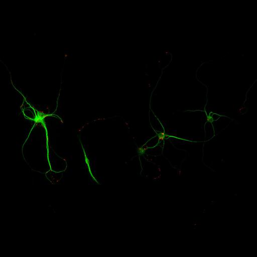  NCBI Organism:Rattus; Cell Types:multipolar neuron Cell Components:cytoskeleton, microtubule cytoskeleton, dendrite, synapse part, synaptic vesicle; Biological process:neuron development, dendrite development, protein localization to synapse, establishment of cell polarity;