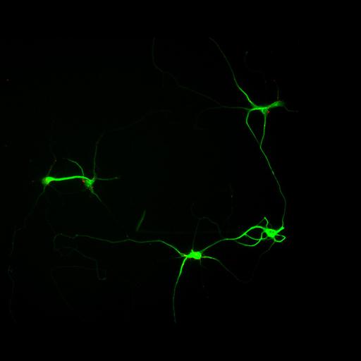  NCBI Organism:Rattus; Cell Types:multipolar neuron Cell Components:cytoskeleton, microtubule cytoskeleton, dendrite, synapse part, synaptic vesicle; Biological process:neuron development, dendrite development, protein localization to synapse, establishment of cell polarity;