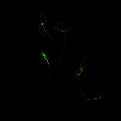  NCBI Organism:Rattus; Cell Types:multipolar neuron Cell Components:cytoskeleton, microtubule cytoskeleton, dendrite, synapse part, synaptic vesicle; Biological process:neuron development, dendrite development, protein localization to synapse, establishment of cell polarity;