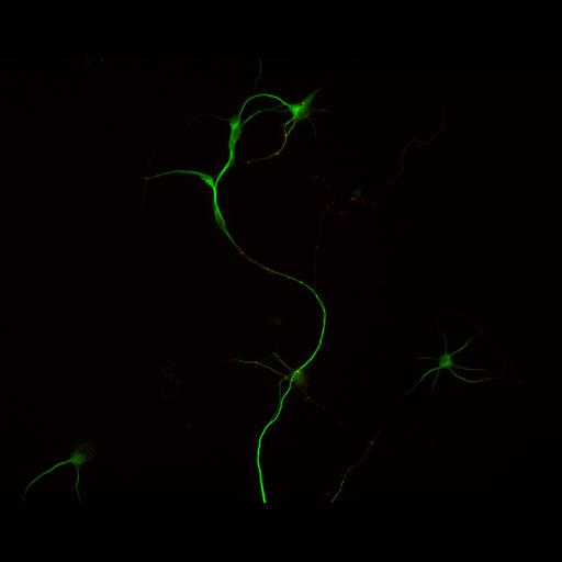  NCBI Organism:Rattus; Cell Types:multipolar neuron Cell Components:cytoskeleton, microtubule cytoskeleton, dendrite, synapse part, synaptic vesicle; Biological process:neuron development, dendrite development, protein localization to synapse, establishment of cell polarity;