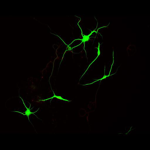  NCBI Organism:Rattus; Cell Types:multipolar neuron Cell Components:cytoskeleton, microtubule cytoskeleton, dendrite, synapse part, synaptic vesicle; Biological process:neuron development, dendrite development, protein localization to synapse, establishment of cell polarity;