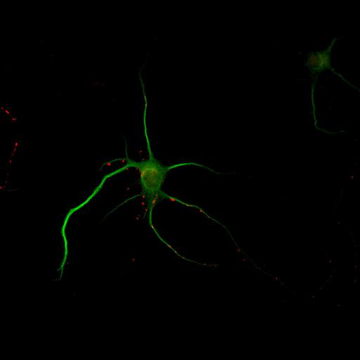  NCBI Organism:Rattus; Cell Types:multipolar neuron Cell Components:cytoskeleton, microtubule cytoskeleton, dendrite, synapse part, synaptic vesicle; Biological process:neuron development, dendrite development, protein localization to synapse, establishment of cell polarity;