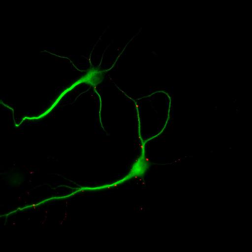  NCBI Organism:Rattus; Cell Types:multipolar neuron Cell Components:cytoskeleton, microtubule cytoskeleton, dendrite, synapse part, synaptic vesicle; Biological process:neuron development, dendrite development, protein localization to synapse, establishment of cell polarity;