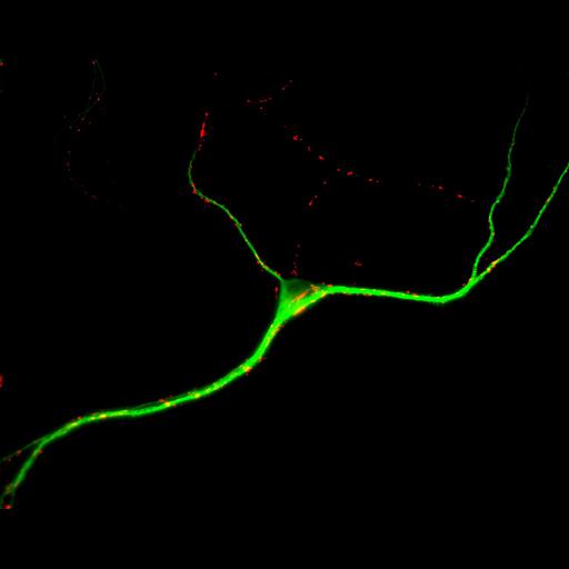  NCBI Organism:Rattus; Cell Types:multipolar neuron Cell Components:cytoskeleton, microtubule cytoskeleton, dendrite, synapse part, synaptic vesicle; Biological process:neuron development, dendrite development, protein localization to synapse, establishment of cell polarity;