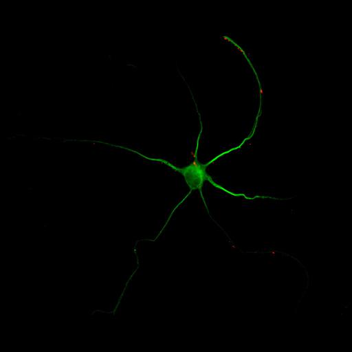  NCBI Organism:Rattus; Cell Types:multipolar neuron Cell Components:cytoskeleton, microtubule cytoskeleton, dendrite, synapse part, synaptic vesicle; Biological process:neuron development, dendrite development, protein localization to synapse, establishment of cell polarity;