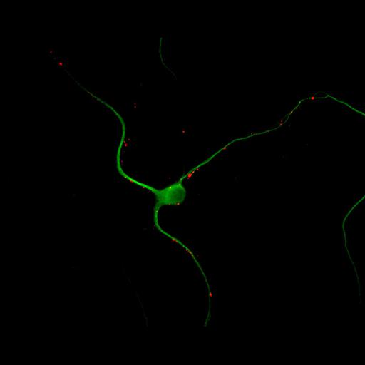  NCBI Organism:Rattus; Cell Types:multipolar neuron Cell Components:cytoskeleton, microtubule cytoskeleton, dendrite, synapse part, synaptic vesicle; Biological process:neuron development, dendrite development, protein localization to synapse, establishment of cell polarity;