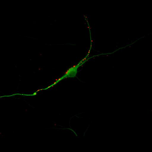  NCBI Organism:Rattus; Cell Types:multipolar neuron Cell Components:cytoskeleton, microtubule cytoskeleton, dendrite, synapse part, synaptic vesicle; Biological process:neuron development, dendrite development, protein localization to synapse, establishment of cell polarity;