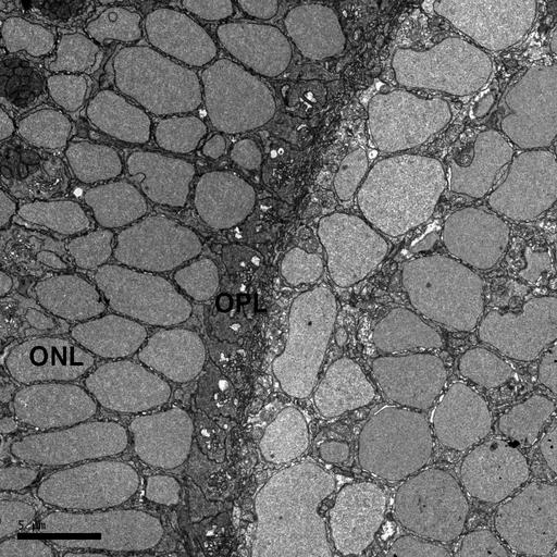  NCBI Organism:Danio rerio; Cell Types:Outer plexiform layer of retina, Outer nuclear layer of retina; Biological process:retina layer formation